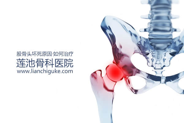 股骨頭壞死原因？如何治療股骨頭壞死？