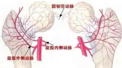 股骨頭壞死和腎虛是否有關(guān)系？