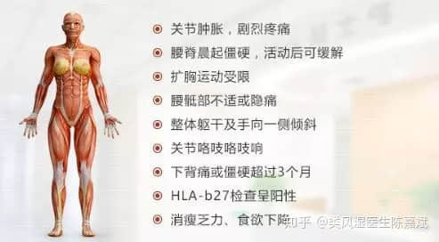 患上了強直性脊柱炎，小心膝關(guān)節(jié)出現(xiàn)關(guān)節(jié)炎。