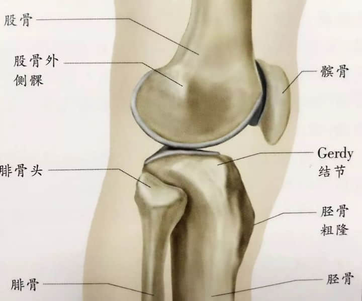 髕骨周?chē)?，膝“打軟”，說(shuō)說(shuō)髕股疼痛綜合征