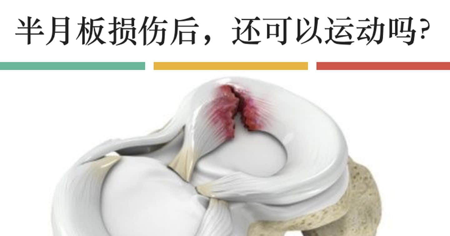 半月板損傷如何發(fā)生？半月板損傷多久能恢復(fù)
