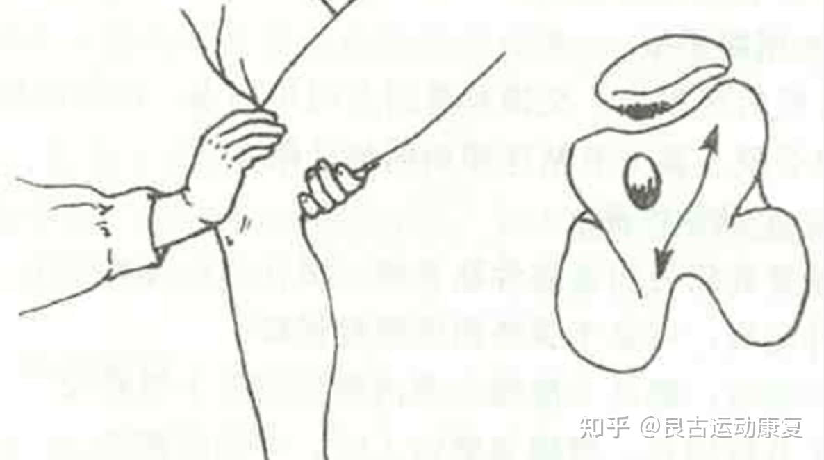 這個膝痛是最常見的運(yùn)動損傷，如何自我康復(fù)？