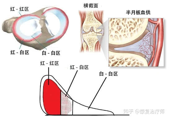 半月板損傷了，選擇修復還是切除？