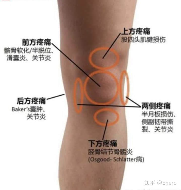 膝關節(jié)總發(fā)出聲響是怎么回事？
