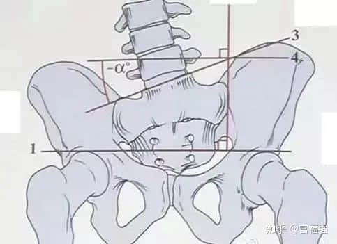 蹺二郎腿，是怎么讓人悄悄“變丑”的？
